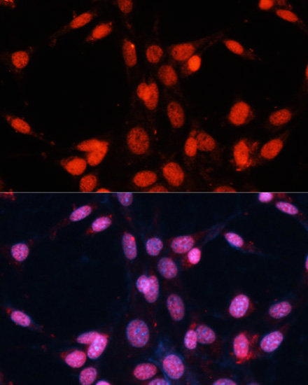 FUS Polyclonal Antibody