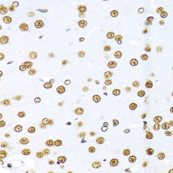 KHDRBS1 Rabbit Polyclonal Antibody