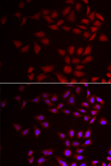 MMP10 Antibody