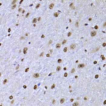 SOX5 Polyclonal Antibody