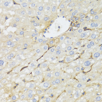 STAT4 Rabbit Polyclonal Antibody