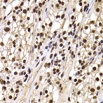 HIRIP3 Polyclonal Antibody