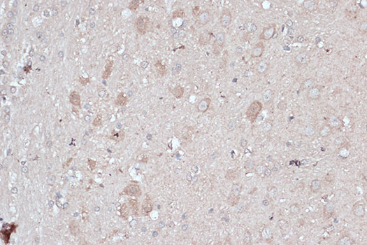 LC3B Polyclonal Antibody