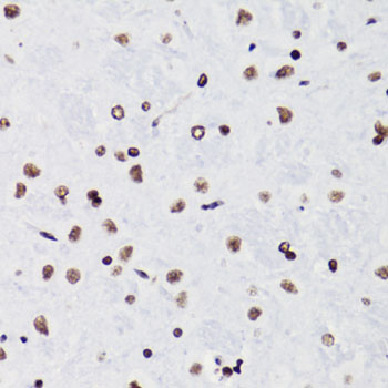 Acetyl-Histone H3-K18 pAb