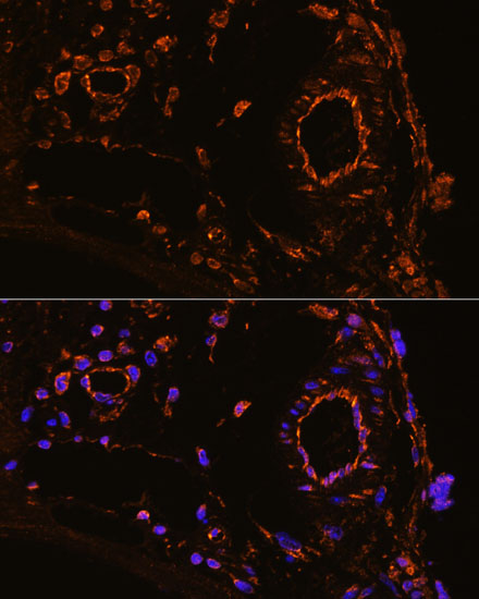 YBX1 Polyclonal Antibody