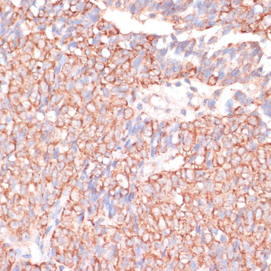 ACAT2 Rabbit Polyclonal Antibody