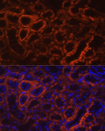 CDH16 Rabbit Polyclonal Antibody