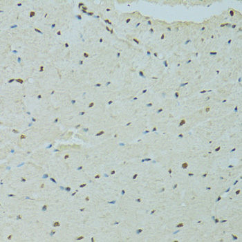 SAFB Polyclonal Antibody