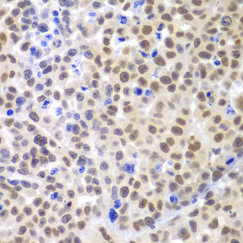 LHX4 Polyclonal Antibody
