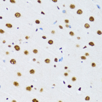 DDX39B Rabbit Polyclonal Antibody