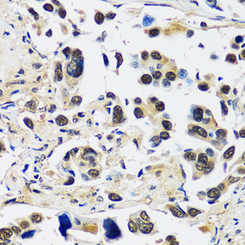 CCDC59 Polyclonal Antibody