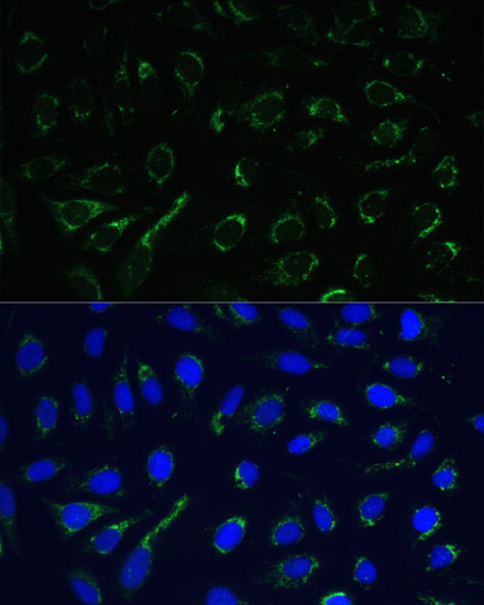IDH3A Polyclonal Antibody