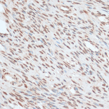 ZNF574 Polyclonal Antibody