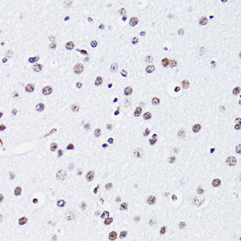 Acetyl-Histone H2B-K15 pAb