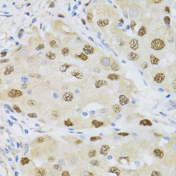CDK6 antibody