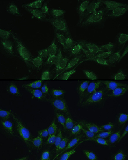 BLOC1S3 Polyclonal Antibody