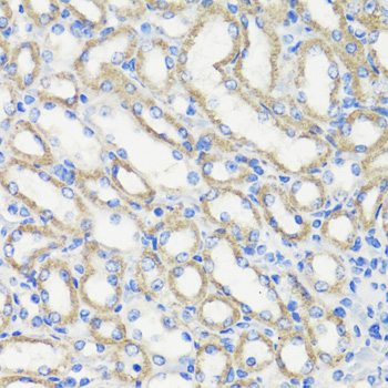 DEPDC6 Polyclonal Antibody