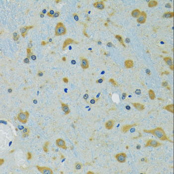 RPS7 antibody