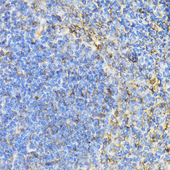 STAT4 Rabbit Polyclonal Antibody