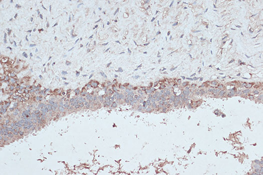 LC3B Polyclonal Antibody