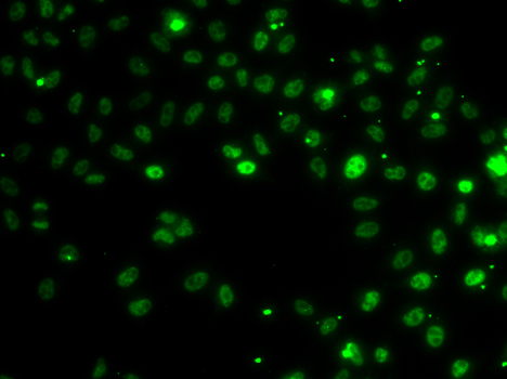 RSRC1 Polyclonal Antibody