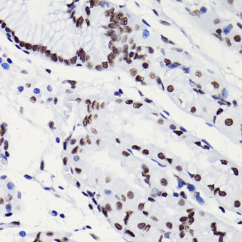Acetyl-Histone H3-K18 pAb