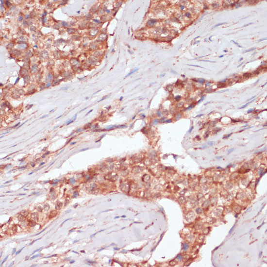ACAT2 Rabbit Polyclonal Antibody