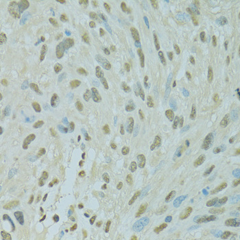 SAFB Polyclonal Antibody