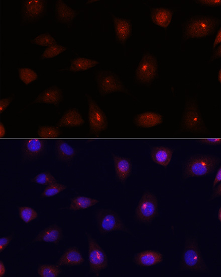 CETN3 Rabbit Polyclonal Antibody