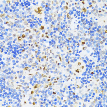 DDX39B Rabbit Polyclonal Antibody