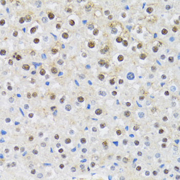 CDK6 antibody