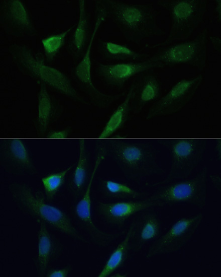 SMAD2/SMAD3 Polyclonal Antibody