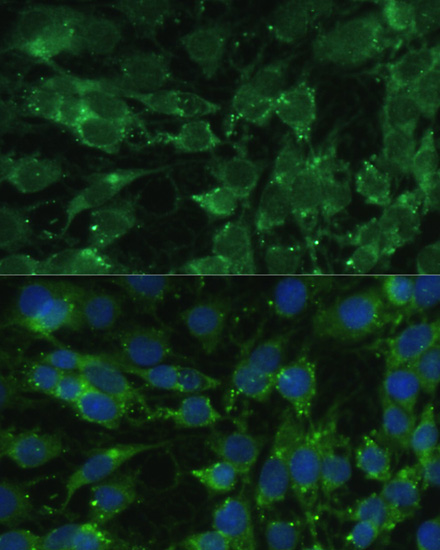 BLOC1S3 Polyclonal Antibody