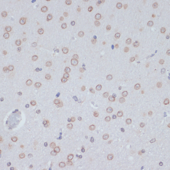 Lamin A / C Polyclonal Antibody