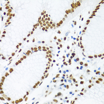 KHDRBS1 Rabbit Polyclonal Antibody