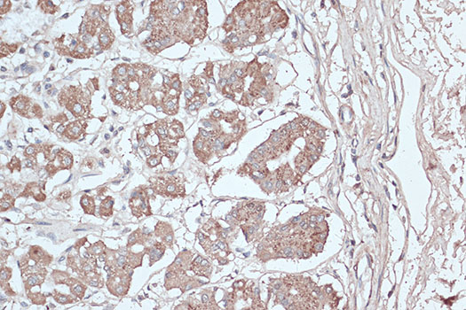 LC3B Polyclonal Antibody