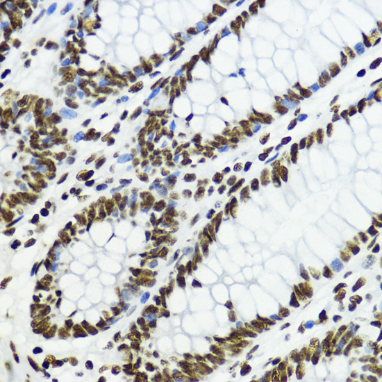 Histone H3K27AC antibody