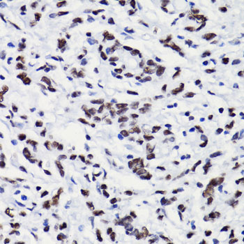 Acetyl-Histone H3-K18 pAb
