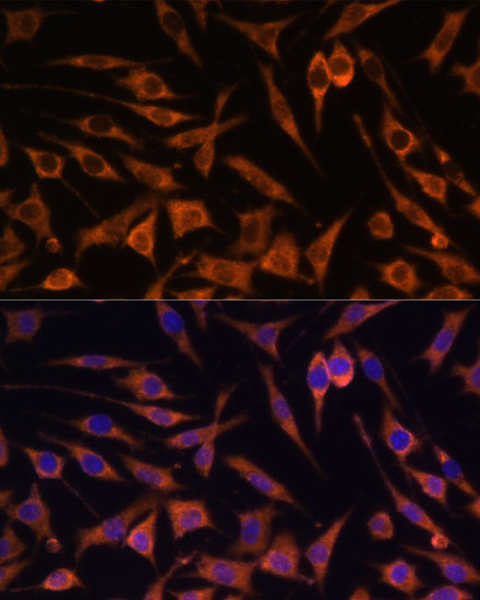 ACAT2 Rabbit Polyclonal Antibody