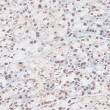 ZNF574 Polyclonal Antibody