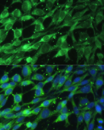 BLOC1S3 Polyclonal Antibody