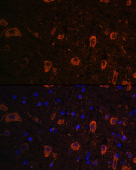 LC3B Polyclonal Antibody