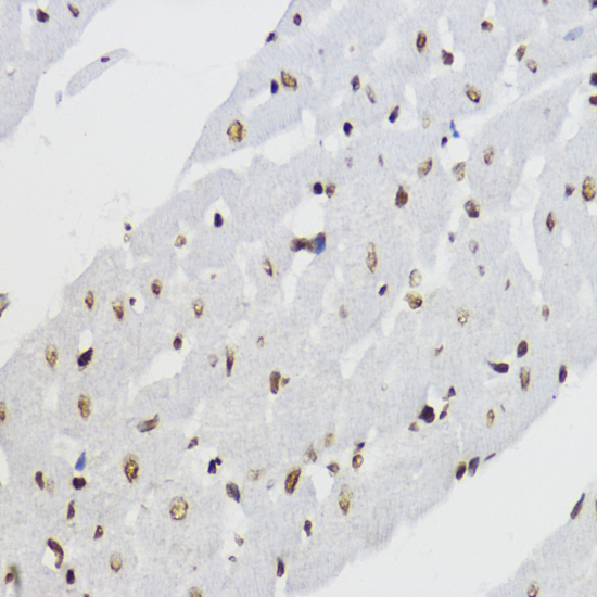 Histone H3K27AC antibody