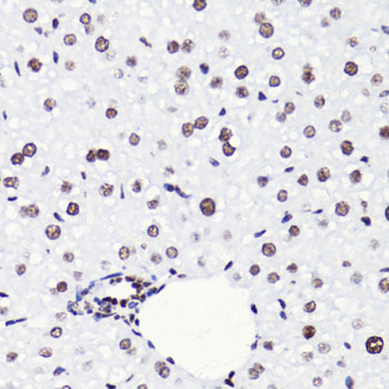 Acetyl-Histone H3-K18 pAb