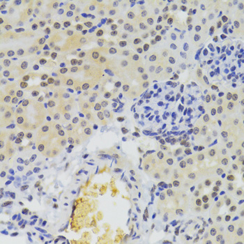 HNRNPA1 Polyclonal Antibody