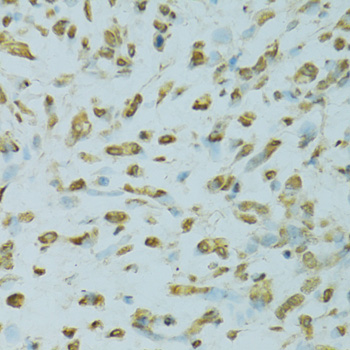 SAFB Polyclonal Antibody