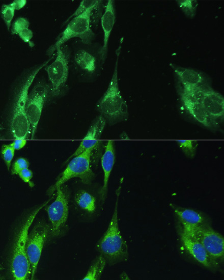 BLOC1S3 Polyclonal Antibody