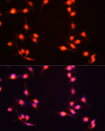 S100B antibody