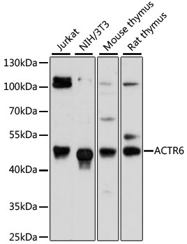 ACTR6 Polyclonal Antibody