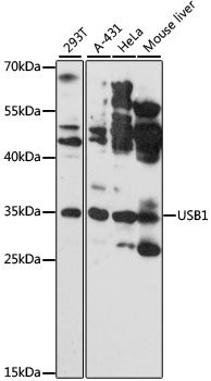 USB1 Polyclonal Antibody
